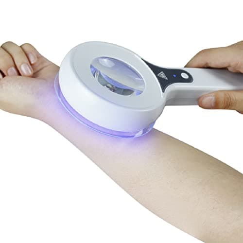 Woods Lamp Skin Analyzer for Face Care and Diagnosis