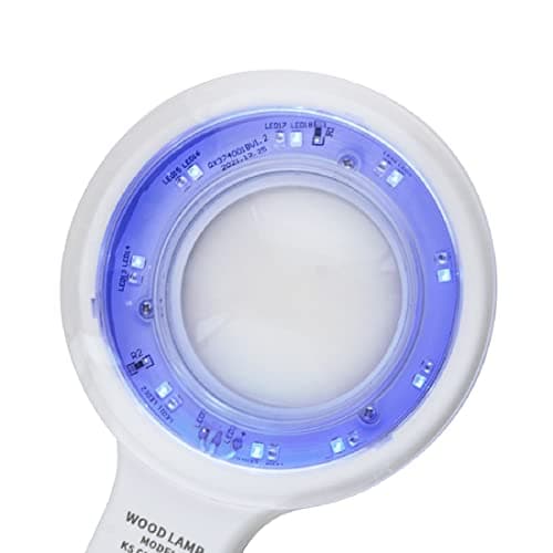 Woods Lamp Skin Analyzer for Face Care and Diagnosis